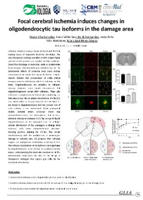 Focal cerebral ischemia induces changes in oligodendrocytic tau isoforms in the damaged area
