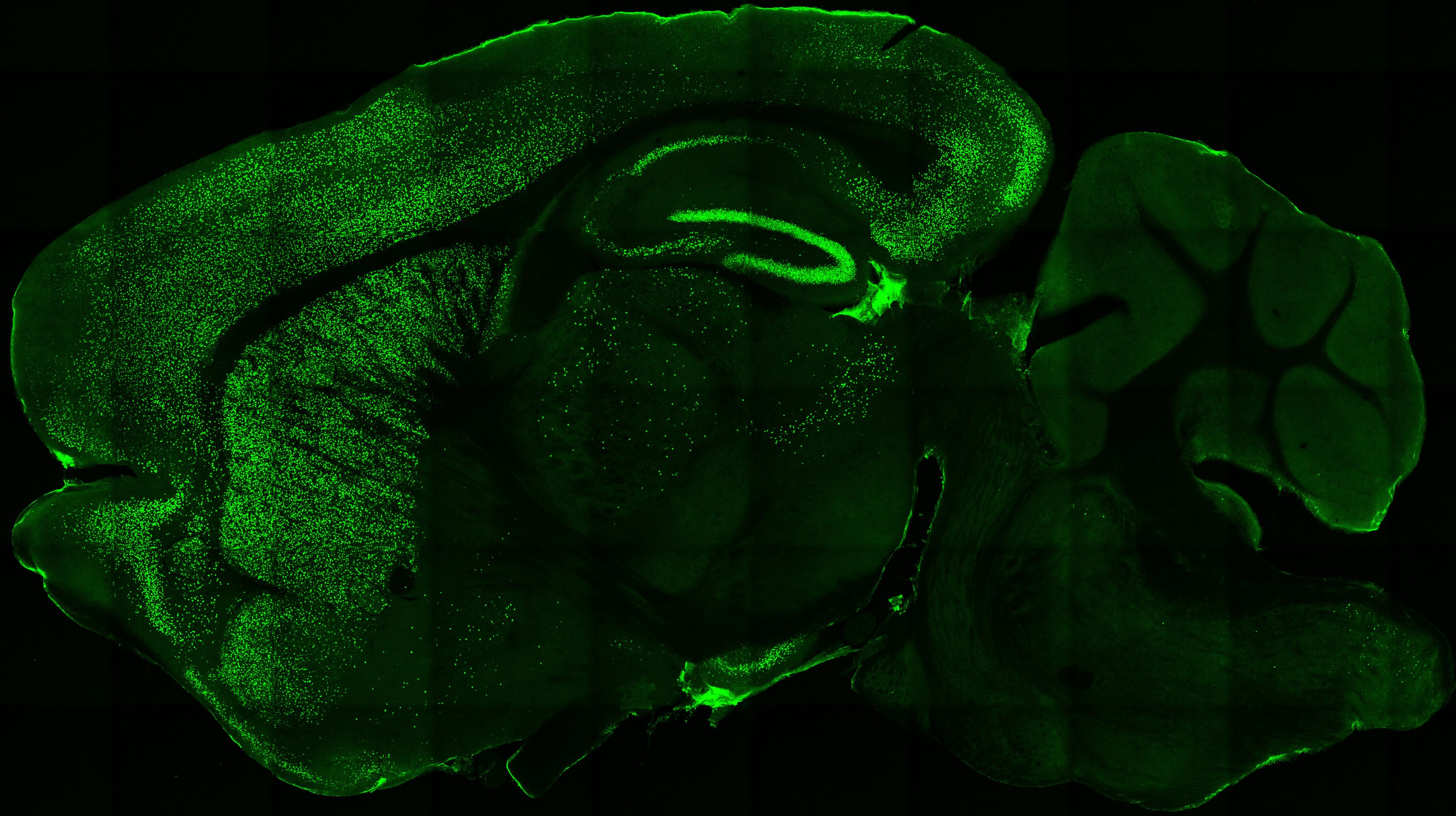 Corte transversal de cerebro de ratón transgénico