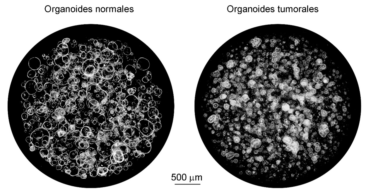 Imágenes microscópicas de organoides