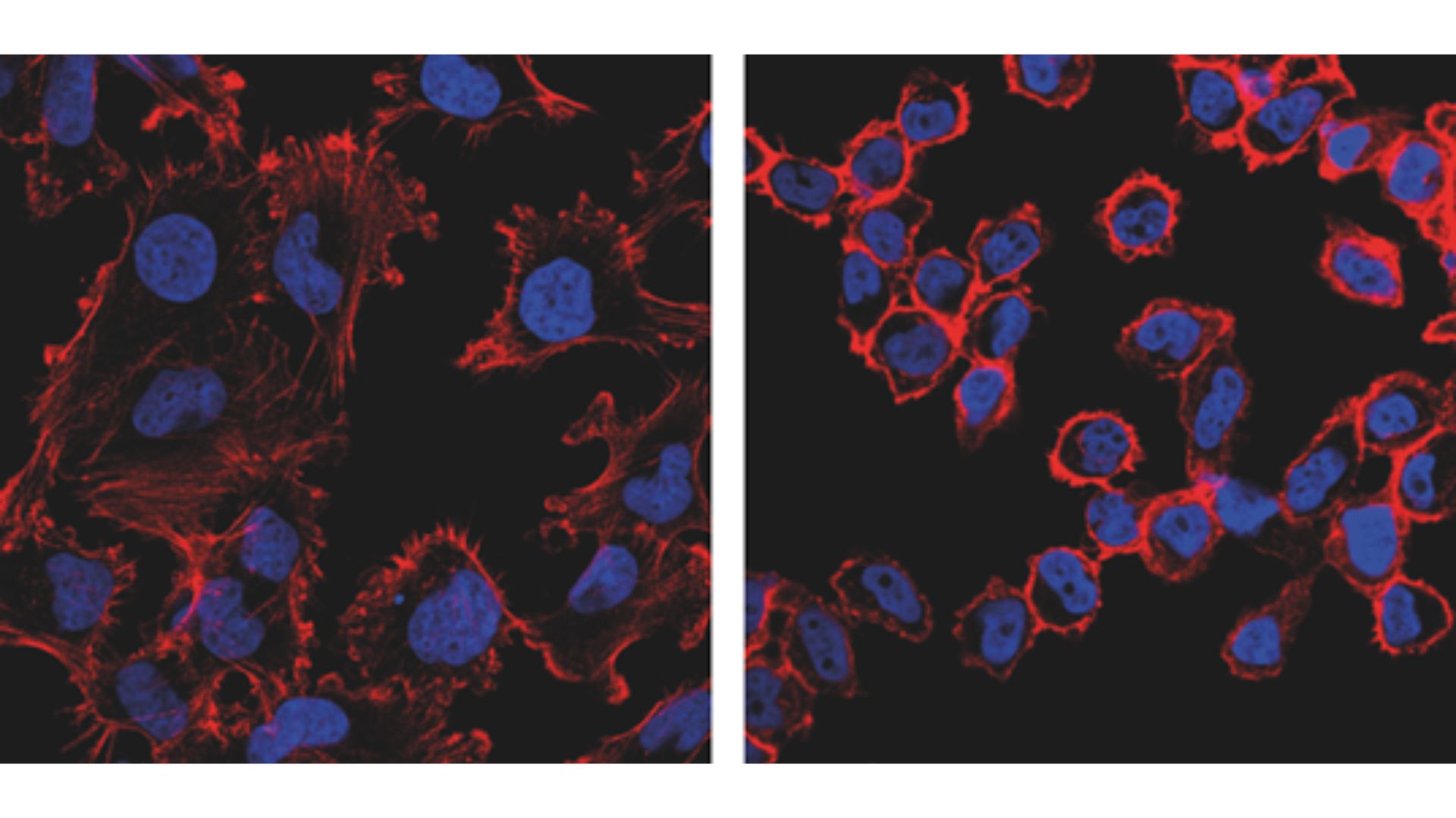 Imágenes de microscopía óptica de células tumorales con el citoesqueleto de actina en rojo y los núcleos celulares en azul. La imagen de la derecha muestra el colapso del citoesqueleto. / Grupos de Y. Revilla y J.M. Almendral, CBM