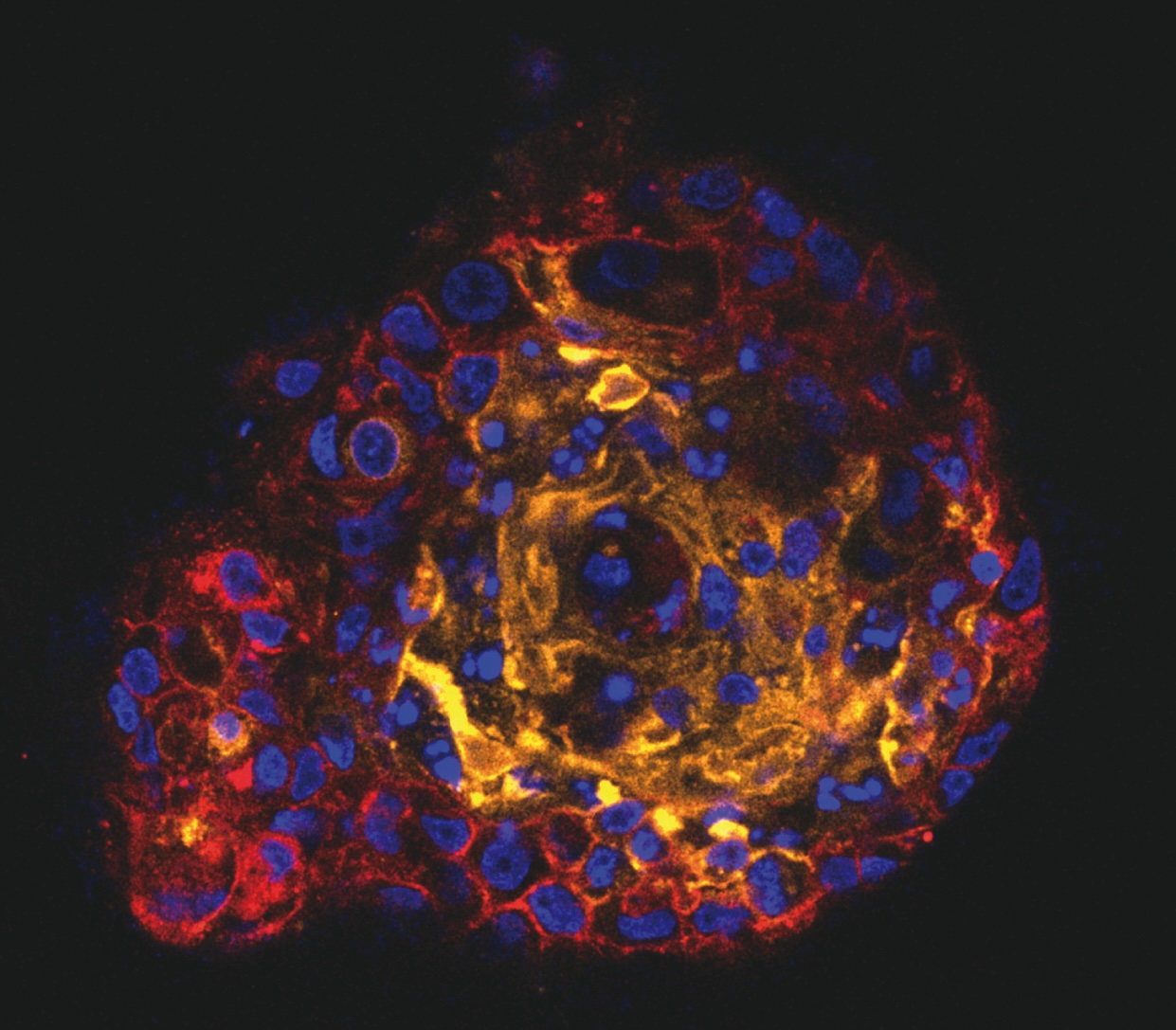 Imagen de inmunofluorescencia que muestra el interior de un organoide trofoblástico, una estructura tridimensional que reproduce en el laboratorio características clave de la placenta. / Paula Doria-Borrell y Ana Ferrero-Micó